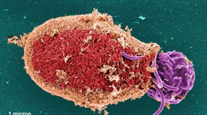 Imagine asociată articolului „O nouă metoda pentru detectarea Toxoplasma gondii”
